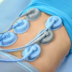 RT700 Interference Electric Therapy Device Interference electric therapy device