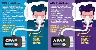 portable cpap machine