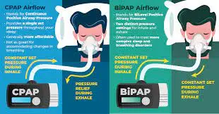 portable cpap machine