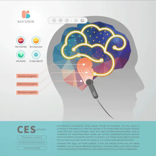 CES