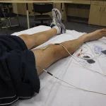 nmes neuromuscular electrical stimulation