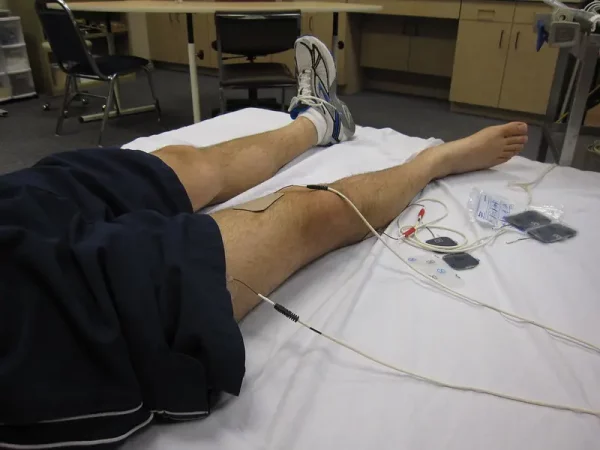 nmes neuromuscular electrical stimulation