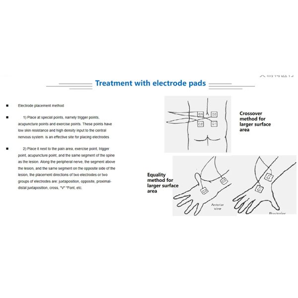 What is Transcutaneous Electrical Nerve Stimulation (TENS)?