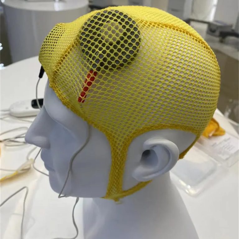 Transcranial-Direct-Current-Stimulation-tDCS-for-ADHD-therapy