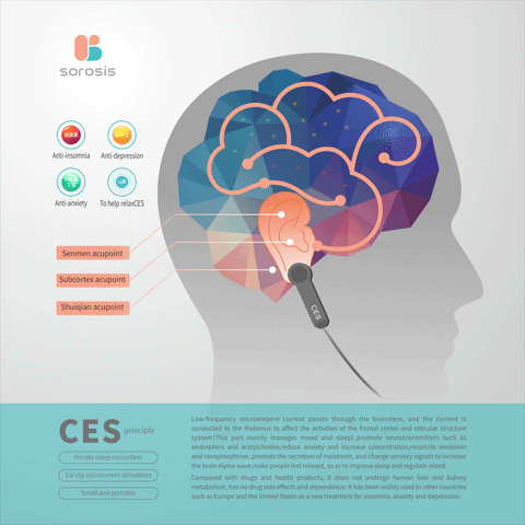 What Is Ces